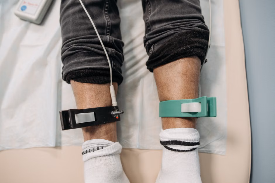 Close-up view of medical electrodes on a patient's lower legs during a medical procedure in a clinic.